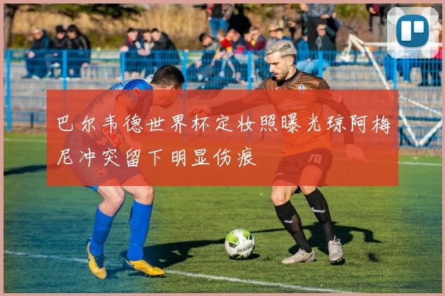 巴尔韦德世界杯定妆照曝光琼阿梅尼冲突留下明显伤痕